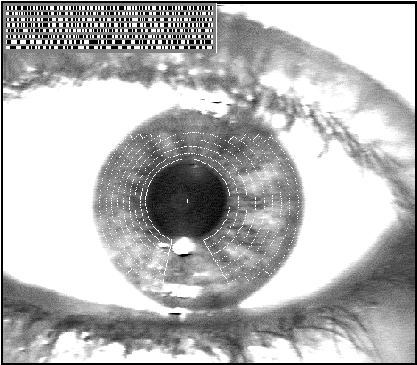 close up of eye and demarcated zones